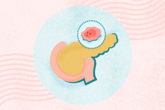 What Is Pancreatic Cancer?