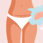 does a c section affect the baby