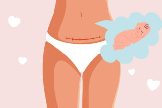 does a c section affect the baby