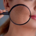 Winter skincare tips: Dermat says avoid long hot showers, apply richer creams