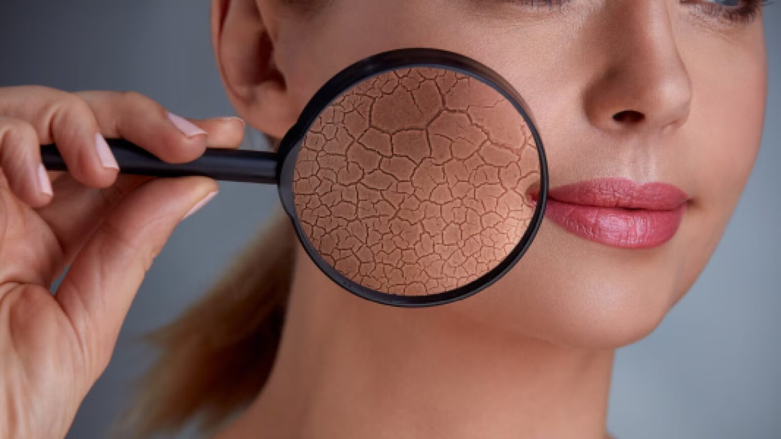 Winter skincare tips: Dermat says avoid long hot showers, apply richer creams